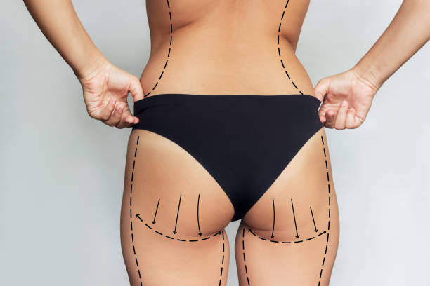 Do butt lifting panties really enhance your curves?
