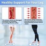 Medical Compression Pantyhose for Women & Men, 20-30mmHg Graduated Support Compression Tights Footless Medical Compression Stockings & Leggings for Edema, Varicose Veins, Swelling(Black,L)