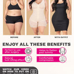 M&D Post Surgery Stage 2 BBL Compression Garment Fajas Colombiana Post OP | Shapewear for Women Beige X-Small
